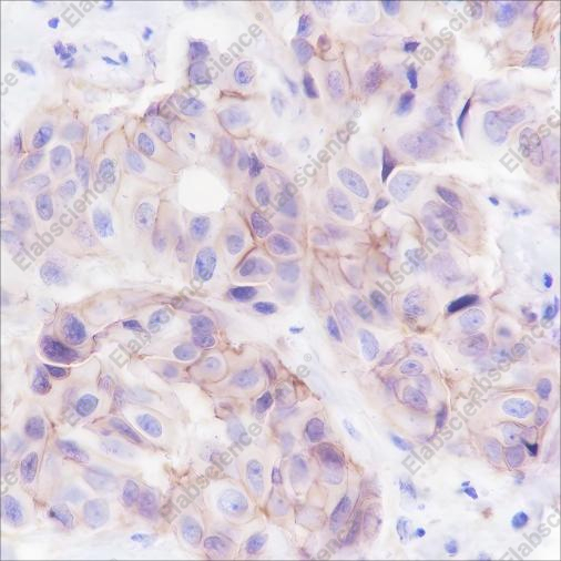 Recombinant EphA2 Monoclonal Antibody - 2