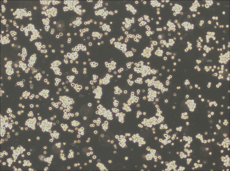 Akata Cell Complete Medium-searchlist-1