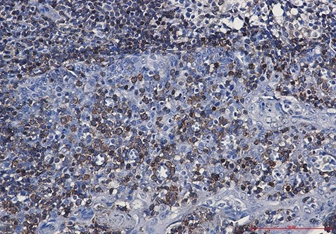 Recombinant CD79a Monoclonal Antibody - 2