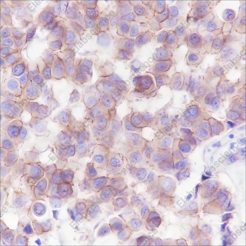 Recombinant PI3 Kinase p110 alpha Monoclonal Antibody - 2