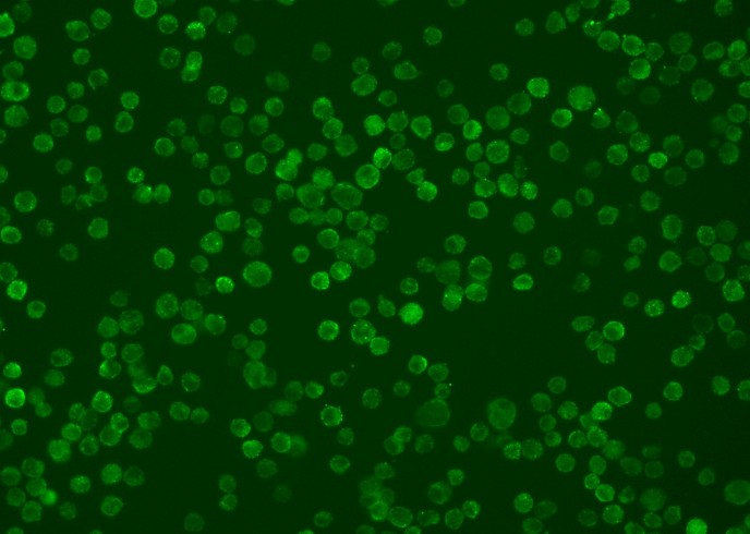 Recombinant HVEM/TNFRSF14/CD270 Monoclonal Antibody-searchlist-1