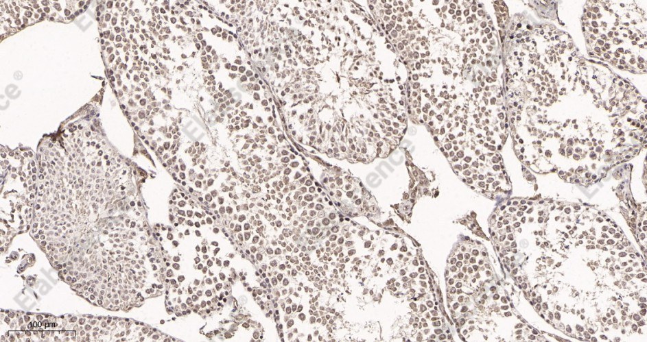 Recombinant Fibrillarin Monoclonal Antibody - 2