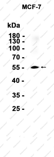 Recombinant Glypican 1 Monoclonal Antibody - 1