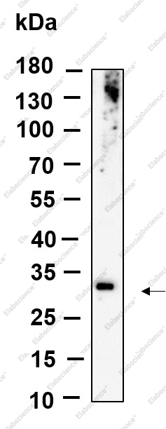 Recombinant ZNF364 Monoclonal Antibody - 1