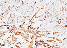 Recombinant CD146/MCAM Monoclonal Antibody-searchlist-1