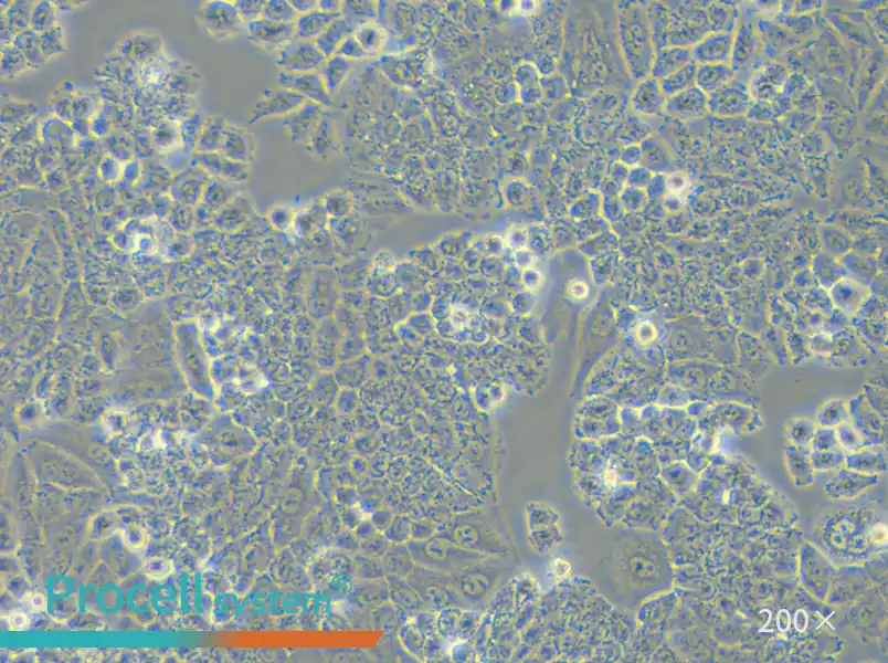 NCI-H460 [H460] Cell Complete Medium - small - 6