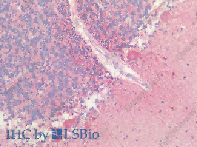 HTR1A Polyclonal Antibody - 2