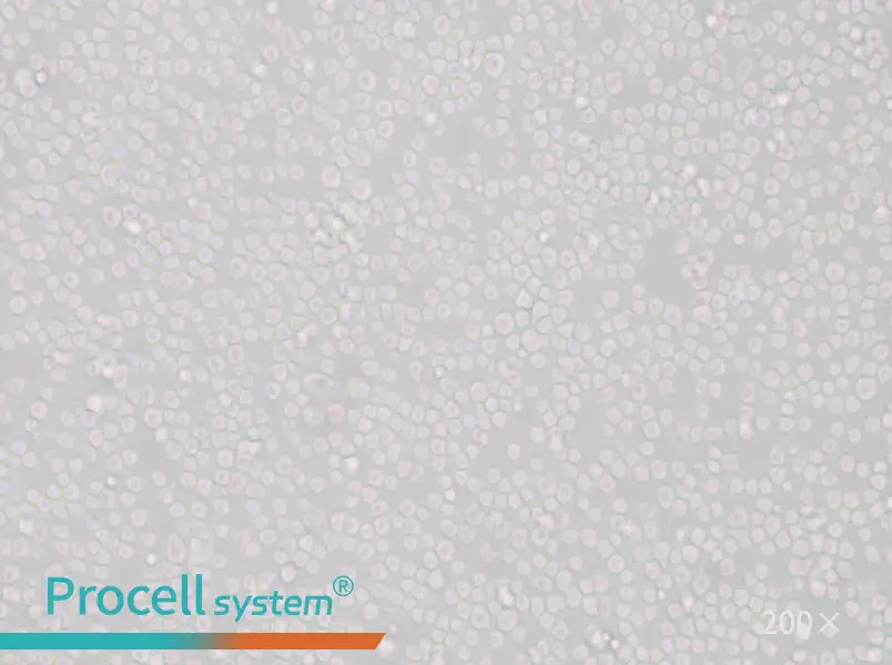 SU-DHL-8 Cell Complete Medium - 6