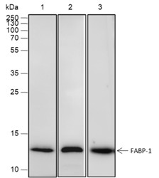 Recombinant FABP1 Monoclonal Antibody-searchlist-1