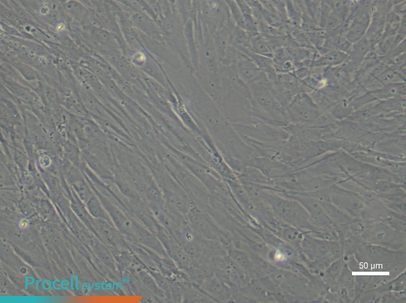 Human Sertoli (Primary cell immortalization) Cell Complete MediumHuman Sertoli (Primary cell immortalization) Cell Complete Medium - 5