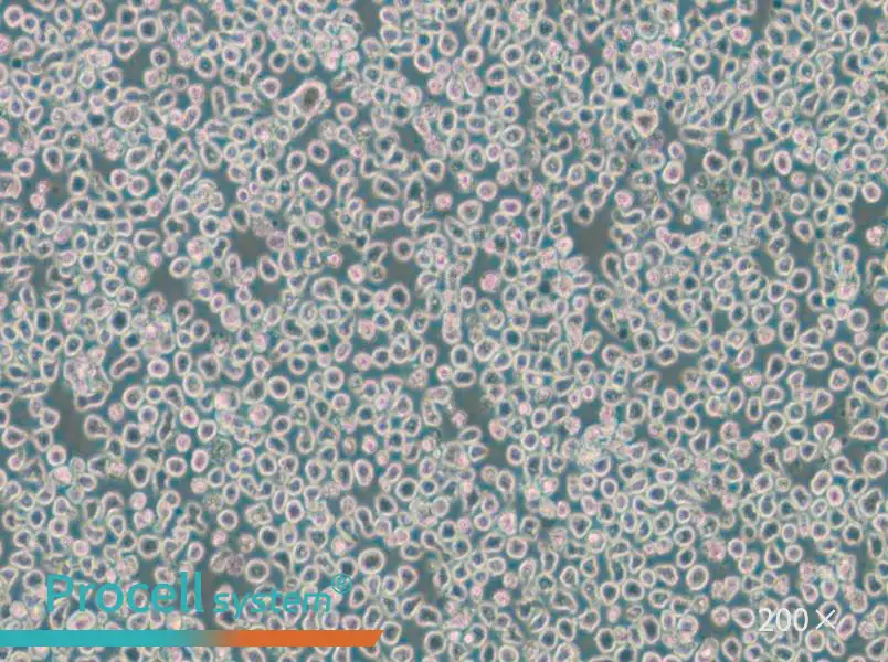 OPM2 Cell Complete Medium - 5