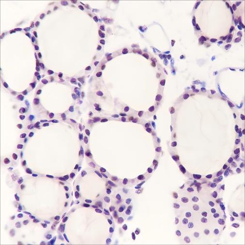Recombinant PAX8 Monoclonal Antibody - 2