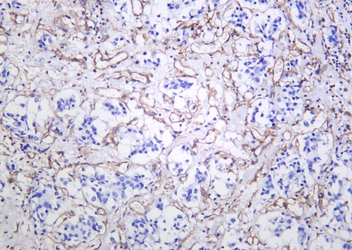 Recombinant CHOP Monoclonal Antibody - small - 2