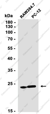Recombinant RPS8 Monoclonal Antibody - 3