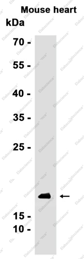 Recombinant 4E-BP1/EIF4EBP1 Monoclonal Antibody - 2