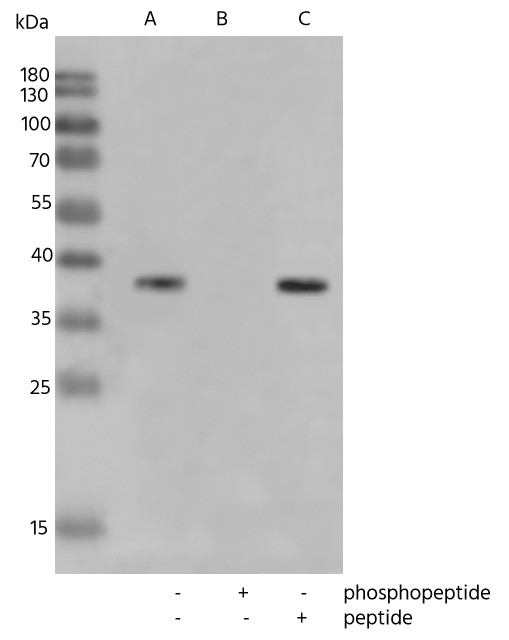 Recombinant Phospho-CrkL (Tyr207) Monoclonal Antibody - small - 2