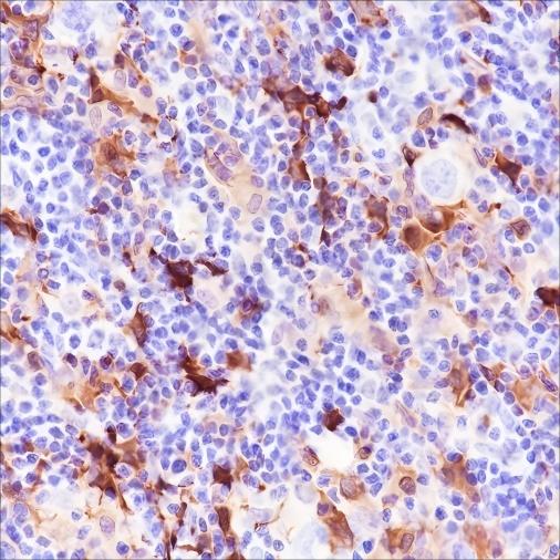 Recombinant Factor XIIIa Monoclonal Antibody - 3