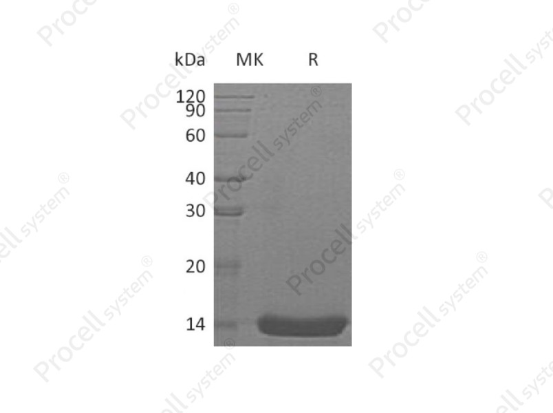 IL-22/IL-TIF, Human, Recombinant