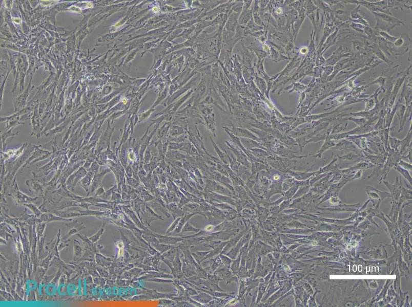 Mouse Pulmonary Artery Smooth Muscle Cell Complete Medium - 1