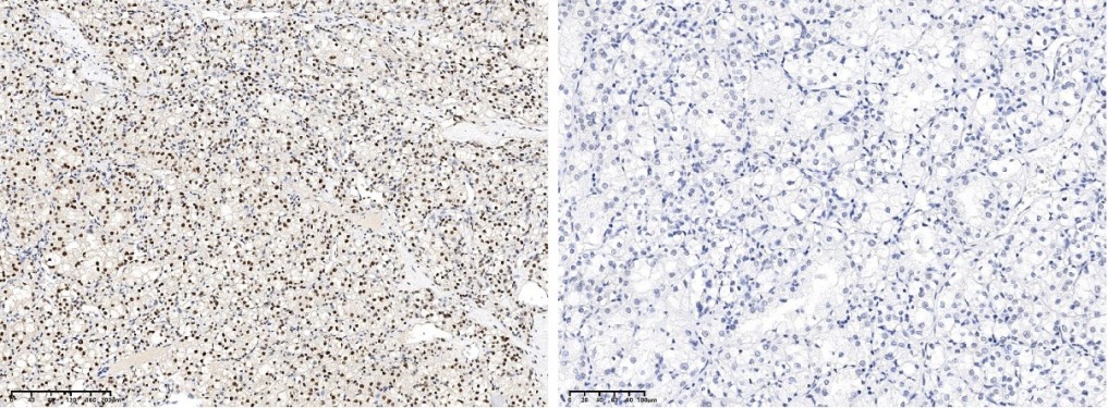 Recombinant Phospho-CREB (Ser133) Monoclonal Antibody - small - 3