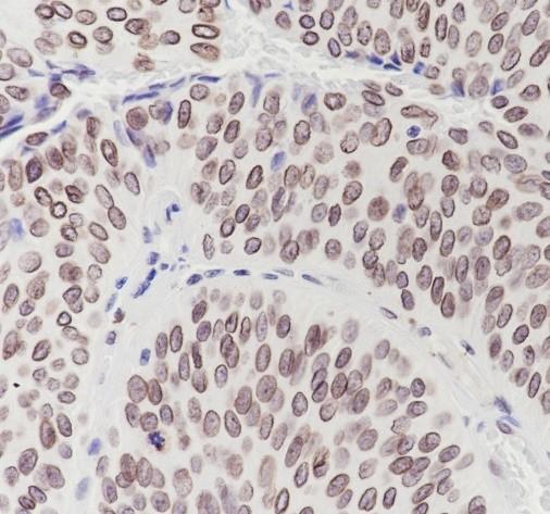 Recombinant Lamin B2 Monoclonal Antibody-searchlist-2