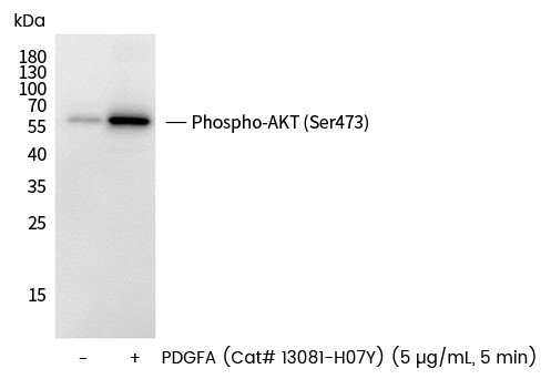 Recombinant Phospho-AKT (Ser473) Monoclonal Antibody-searchlist-1