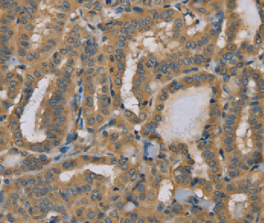 MYL3 Polyclonal Antibody - 2