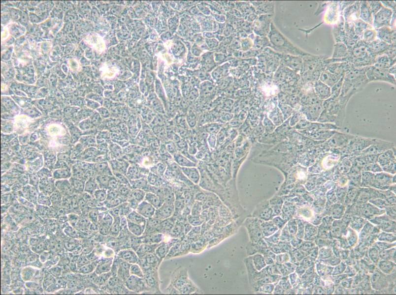 NCI-H2228 [H2228; H-2228] Cell Complete Medium - small - 4