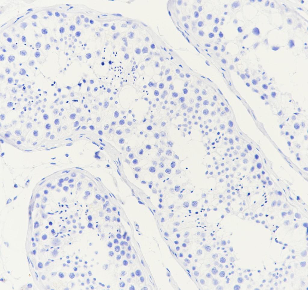 Recombinant Dopamine beta Hydroxylase Monoclonal Antibody - small - 3