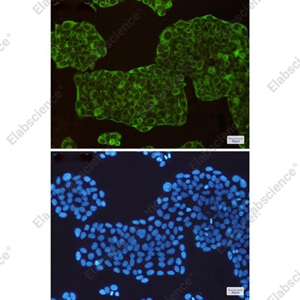 Recombinant ASS1 Monoclonal Antibody - 4