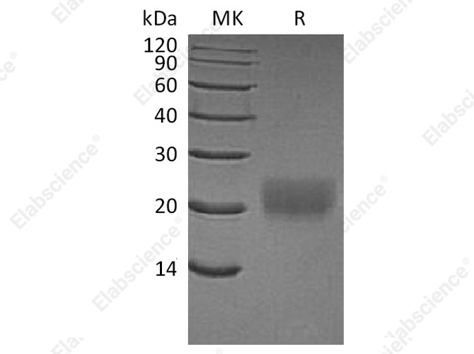 Recombinant Human CTLA4 Protein (His Tag) - 1