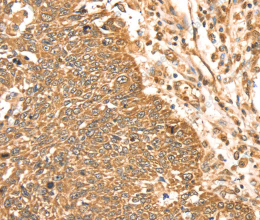 ERK 5 Polyclonal Antibody - 3