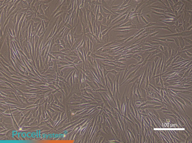 Human Pulmonary Artery Fibroblast Complete Medium - 1