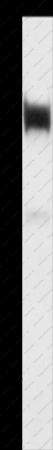 LTF Polyclonal Antibody - 1