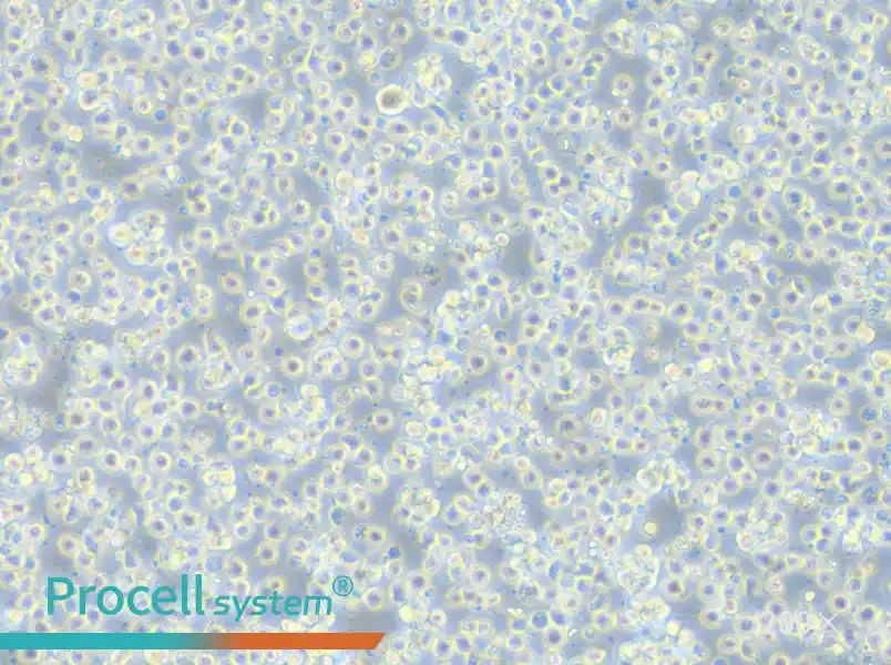 Jurkat clone A3[A3] Cell Complete Medium - small - 4