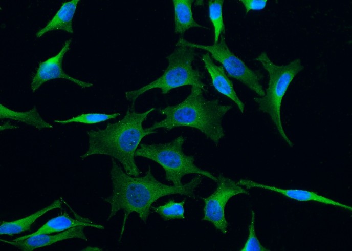 TrkC/NTRK3 Monoclonal Antibody-searchlist-1