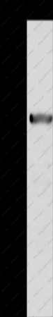 ALDH6A1 Polyclonal Antibody - 1