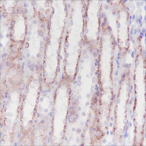 Recombinant GOT1 Monoclonal Antibody - small - 3