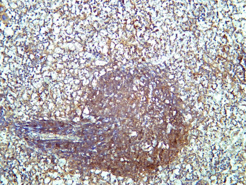 Recombinant SQSTM1/p62 Monoclonal Antibody - 4