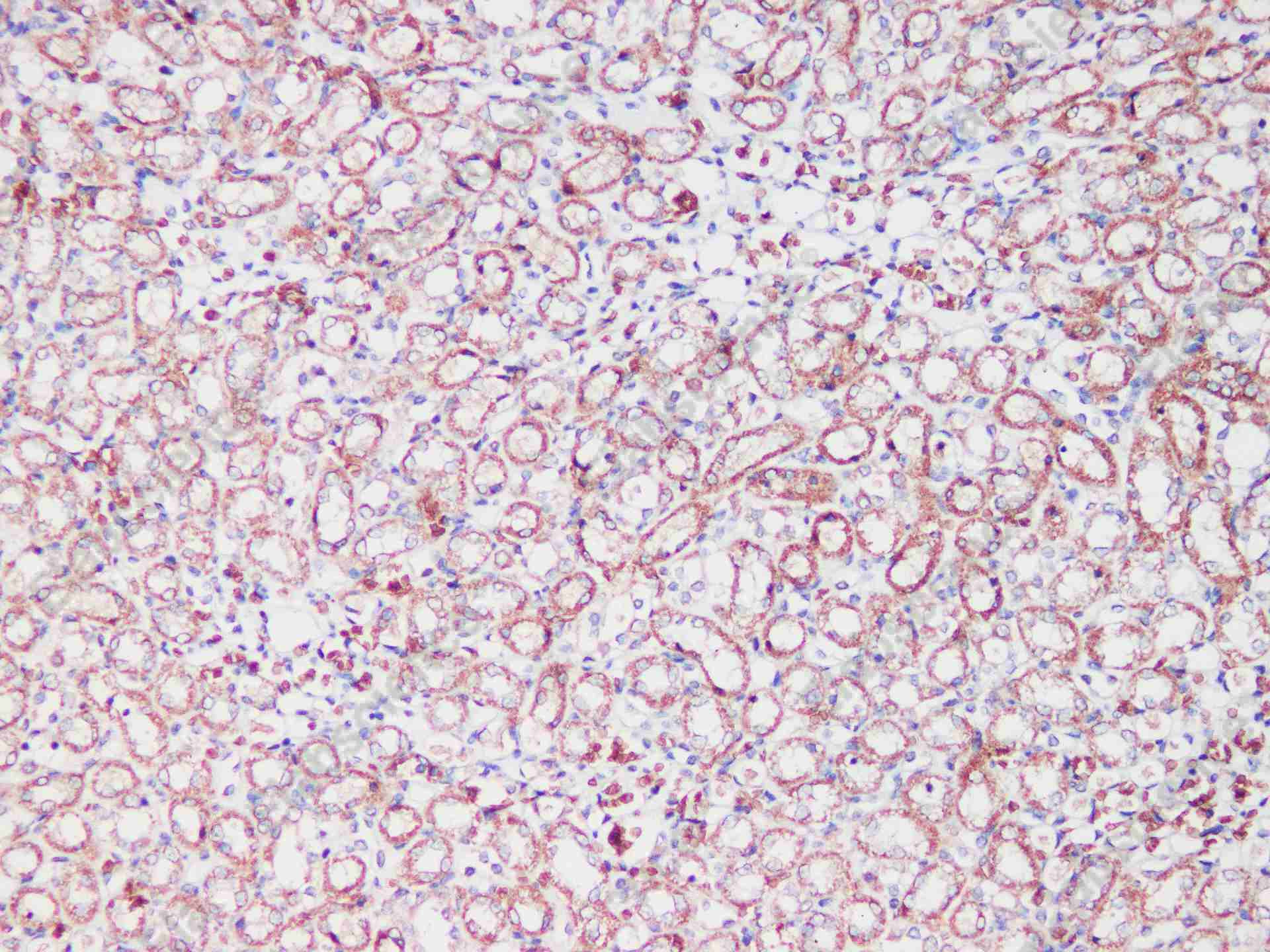 SDHA Polyclonal Antibody - 4