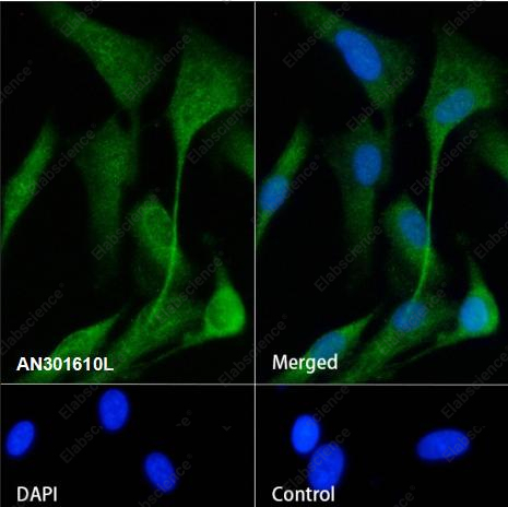 Recombinant Nestin Monoclonal Antibody - 1