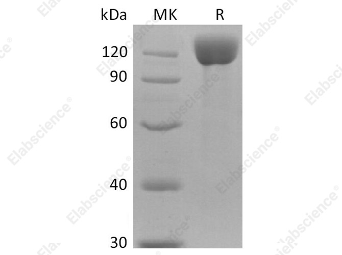 Recombinant Human APN Protein (His Tag) - 1