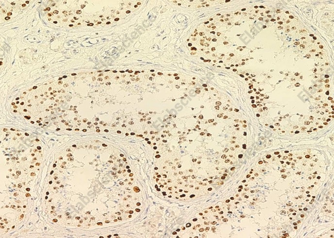 PARP/PARP1 Monoclonal Antibody - 1