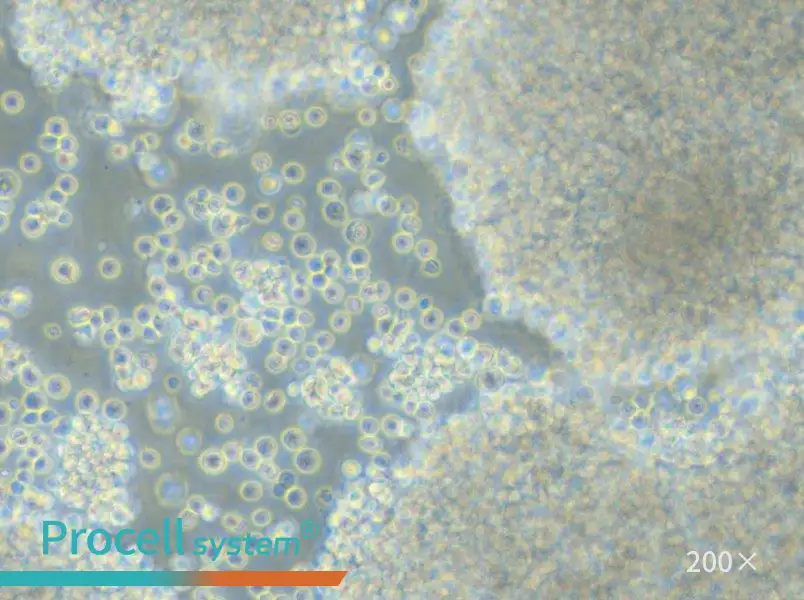 P3HR-1 Cell Complete Medium - small - 6