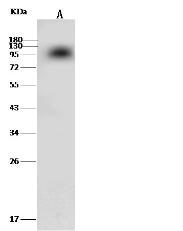 Recombinant Coagulation Factor II/F2 Monoclonal Antibody-searchlist-1