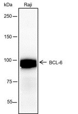 Recombinant BCL6 Monoclonal Antibody-searchlist-1
