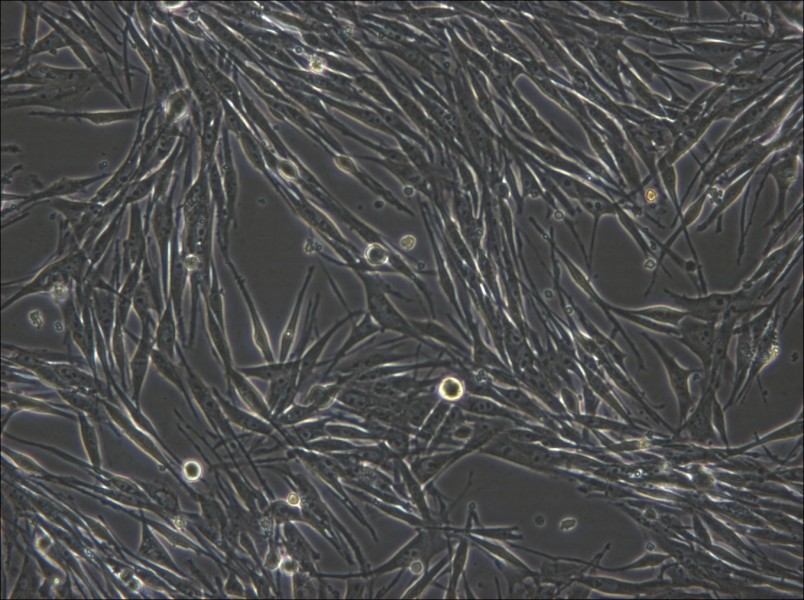 MeWo Cell Complete Medium - 4