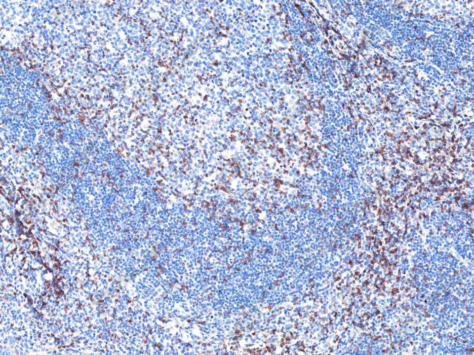 Recombinant CD3e/CD3 epsilon Monoclonal Antibody - 1