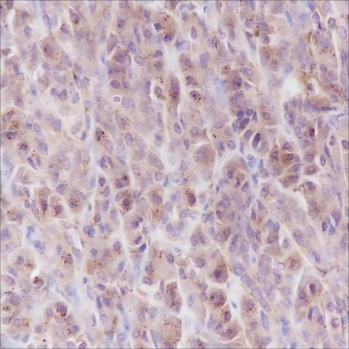 Recombinant PI3 Kinase p85 alpha Monoclonal Antibody - small - 2