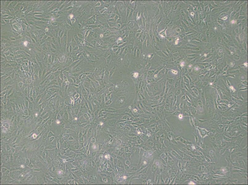 PUMC-HUVEC-T1 Cell Complete Medium - 3